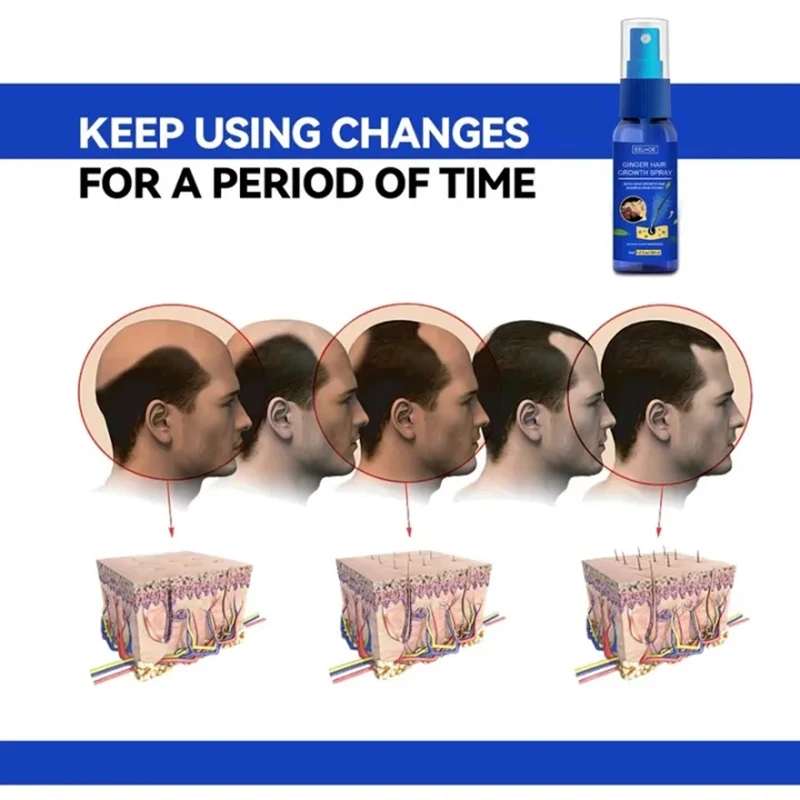 Saç Büyüme Spreyi Hızlı Kalın  - Perfume Zara incelemesi ve fiyatı